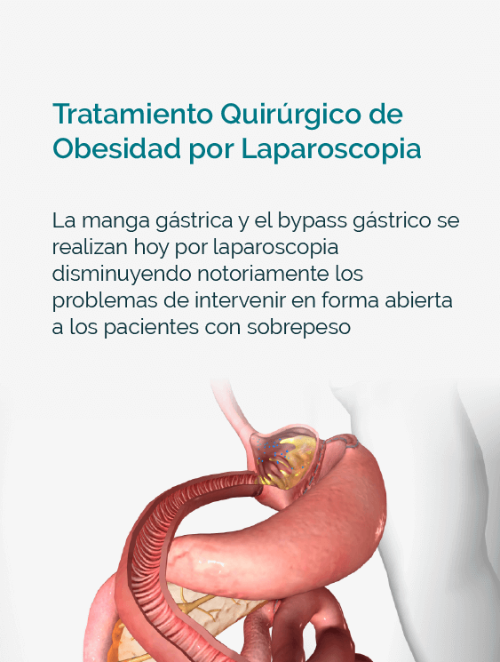 Dr Jorge Daes Cirujano Bariatrico Obesidad En Barranquilla 03 Min